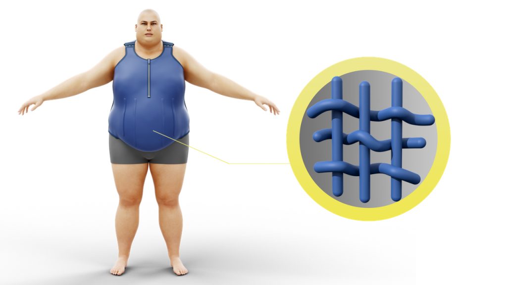 Obesity belt - Abdominal support